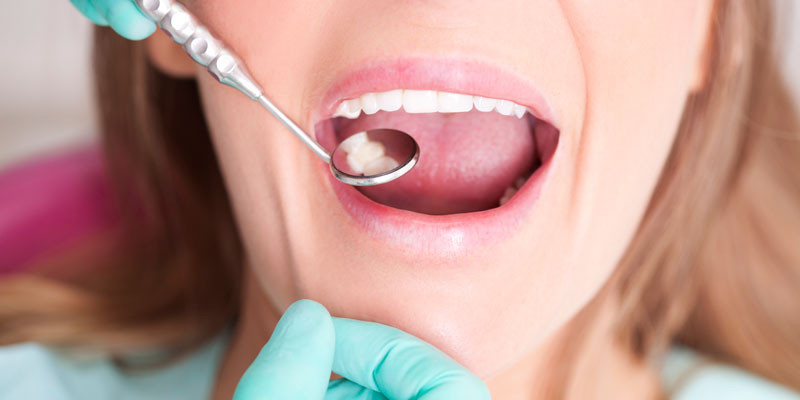 Dental Check for Cavities Dental Check for Cavities