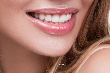 Veneers Specialist - Bellevue, WA: Brilliant Smiles Bellevue: General &  Cosmetic Dentist