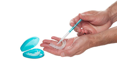 Putting teeth whitening gel in tray